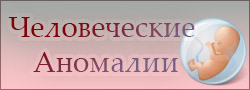 Человеческие аномалии